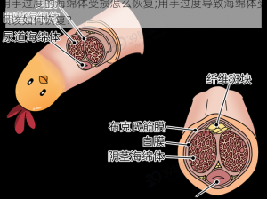 用手过度的海绵体受损怎么恢复;用手过度导致海绵体受损该如何恢复？