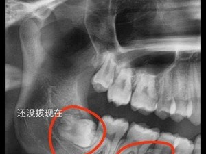 两根一起进去疼拔出来【为什么两根一起进去会疼？拔出来就不疼了吗？】