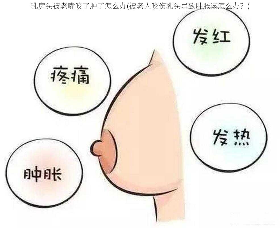 乳房头被老嘴咬了肿了怎么办(被老人咬伤乳头导致肿胀该怎么办？)