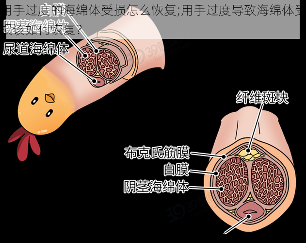 用手过度的海绵体受损怎么恢复;用手过度导致海绵体受损该如何恢复？